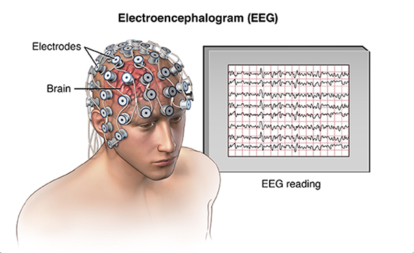 Image of EEG reading