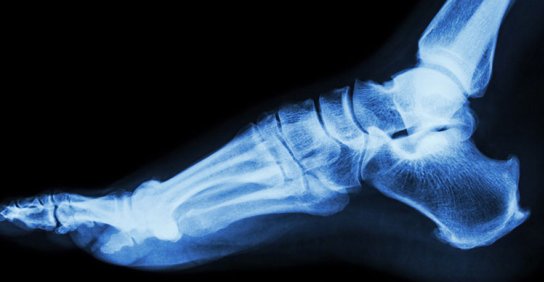 Foot and ankle surgery image